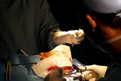 Các bác sỹ tiến hành một ca phẫu thuật. (Ảnh: TTXVN/Vietnam+)