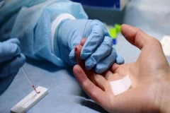 TP.HCM: Nhiều người phải điều trị dự phòng phơi nhiễm HIV do bị đâm
