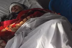 Zarina bị chồng cắt cả hai tai. (Nguồn: BBC)