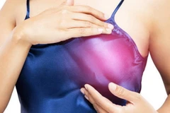 Ảnh minh họa. (Nguồn: Zbc)