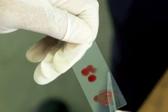 Ảnh minh họa. (Nguồn: citizentv.co.ke)