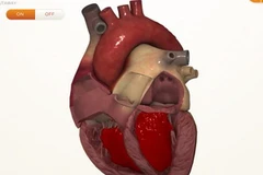 Ảnh minh họa. (Nguồn: orcahealth.com)