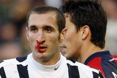 Dù phải đổ máu, Juventus cũng không tránh khỏi thất bại trước Cagliari. (Ảnh: Reuters)