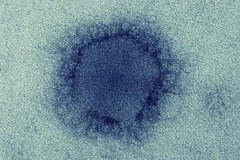 Hội chứng hô hấp ở Trung Đông MERS-CoV. (Nguồn: cidrap.umn.edu)