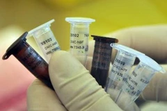 Thuốc thử chẩn đoán H7N9. (Nguồn: THX/TTXVN)