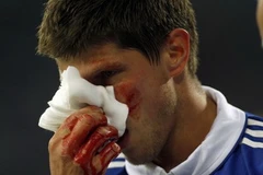 Huntelaar chấn thương. (Nguồn: Reuters)