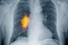 (Ảnh chỉ có tính minh họa/Nguồn: Internet)