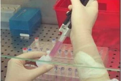 Ảnh minh họa. (Nguồn: medindia.net)