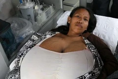 Bà mẹ Julia với bộ ngực quá khổ. (Nguồn: metro.co.uk)