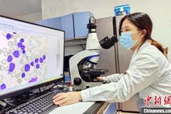 Thiết bị y tế AI - bước đột phá trong quy trình xét nghiệm máu