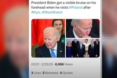 [Video] Vết đen bí ẩn trên trán Tổng thống Mỹ Joe Biden gây bão mạng