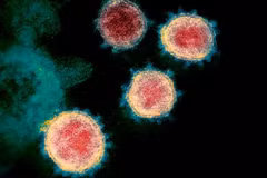 Mở rộng giải trình tự gene với virus gây bệnh hô hấp ngoài COVID-19