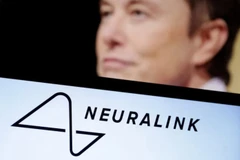 (Nguồn: Neuralink)