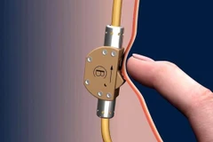 (Nguồn: ydailynews.com)