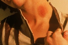 Ảnh minh họa. (Nguồn: thesun)