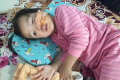 Bình Phước: Bé 3 tuổi bị hai con chó Becgie nhà hàng xóm cắn bị thương