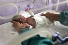 Khoảng 25% trẻ em trên thế giới bị sinh non hoặc sinh thiếu cân