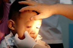 Sở Y tế Thành phố Hồ Chí Minh: Không thiếu thuốc điều trị đau mắt đỏ