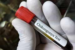 Mỹ phê duyệt vaccine đầu tiên trên thế giới ngừa virus Chikungunya