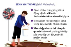 [Infographics] Điều cần biết về bệnh truyền nhiễm nguy hiểm Whitmore