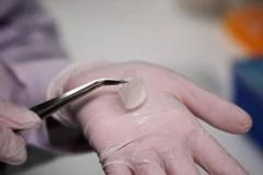 Mẩu da này có tính chất hóa học và sinh học giống da người. (Nguồn: Reuters)