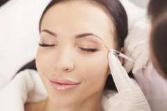 4 phương pháp trị vết chân chim quanh mắt hiệu quả nhất