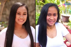 Căn bệnh kỳ lạ khiến cô gái 16 tuổi trông như bà lão 60. (Nguồn: odditycentral.com)