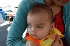 Bệnh nhi sau khi đã được phẫu thuật cắt bỏ hoàn toàn khối bướu. (Ảnh: TTXVN phát)