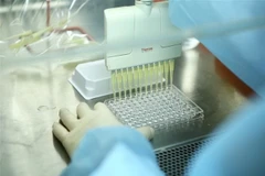 Nhóm nhà khoa học nữ Viện Vệ sinh Dịch tễ Trung ương thực hiện phân lập virus SARS-CoV-2. (Ảnh: Minh Quyết/TTXVN)