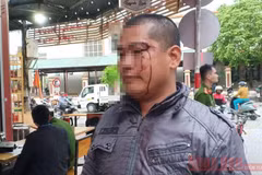Anh Triệu La Luyện bị đánh gây thương tích, chảy máu vùng mặt. (Nguồn: Báo Nhân Dân)