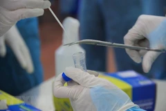 Lấy mẫu xét nghiệm SARS-CoV-2. (Ảnh minh họa: Đinh Hằng/TTXVN)