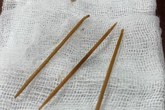 Ba cây tăm được lấy ra khỏi dạ dày bệnh nhân. 