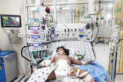 Bệnh nhi sốc sốt xuất huyết nặng được hỗ trợ bằng nhiều máy móc, thiết bị hiện đại tại Bệnh viện Nhi đồng Thành phố. (Ảnh: TTXVN phát)