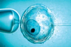 Nguồn gen ảnh hưởng phương pháp thụ tinh ống nghiệm 