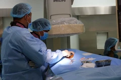 Các êkíp của Bệnh viện Nhi Đồng 2 và Bệnh viện Đa khoa tỉnh Ninh Thuận đã tiến hành phẫu thuật thông tim can thiệp cho 3 bệnh nhi. (Ảnh: TTXVN phát)