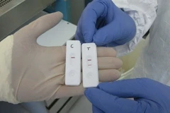 Triển khai thử nghiệm thiết bị phát hiện Ebola trong 15 phút