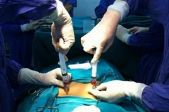 Đột phá mới giúp điều trị chứng liệt bằng cấy ghép tế bào 