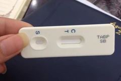 Người dùng chỉ cần nhúng que thử vào nước tiểu của vật nuôi khoảng 5 phút, khi chữ T trên que thử mất đi có nghĩa là trong vật nuôi đó vẫn tồn dư các chất cấm. (Ảnh: PV/Vietnam+)