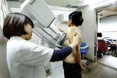 Khám sàng lọc ung thư vú. (Ảnh: Dương Ngọc/TTXVN)
