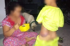 Long An: Đình chỉ công tác giáo viên đánh học sinh bầm tím