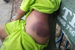 Long An: Xác minh, làm rõ thông tin học sinh lớp 1 bị cô giáo đánh