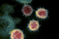 Hình ảnh virus SARS-CoV-2 được soi dưới kính hiển vi. (Ảnh: AFP/TTXVN)