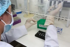 Test xác định virus SARS-CoV-2. (Ảnh: Dương Giang/TTXVN)