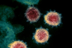 Ảnh minh họa. (Nguồn: amfar.org)