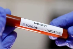 Ảnh minh họa. (Nguồn: azernews.az) 