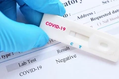 Đài Loan tham gia vào cuộc đua sản xuất kit xét nghiệm COVID-19