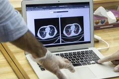 Hệ thống chân đoán COVID-19 qua hình chụp CT. (Ảnh: Fars News)