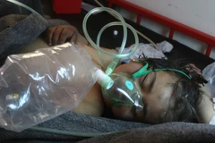 Nạn nhân một vụ tấn công hóa học tại Syria. (Ảnh: AFP)