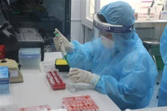 Xét nghiệm phát hiện SARS-CoV-2 bằng kỹ thuật RT-PCR. (Ảnh: Bích Huệ/TTXVN)