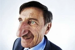 Người đàn ông có chiếc mũi dài nhất thế giới. (Nguồn: Internet)